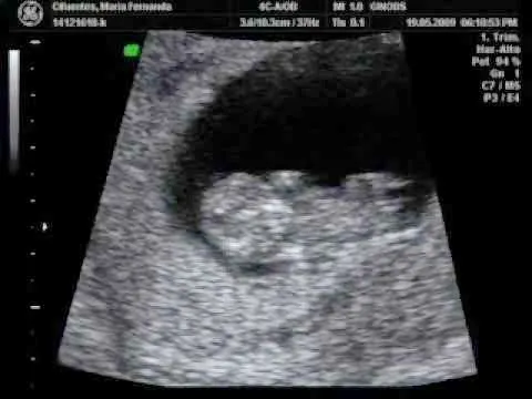 MATERNIDAD Y PSICOLOGÍA ☼: ECOGRAFIAS POR SEMANAS. Imágenes MATERNIDAD Y PSICOLOGÍA ☼: ECOGRAFIAS POR SEMANAS. Imágenes