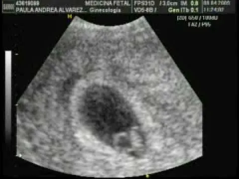 MATERNIDAD Y PSICOLOGÍA ☼: ECOGRAFIAS POR SEMANAS. Imágenes MATERNIDAD Y PSICOLOGÍA ☼: ECOGRAFIAS POR SEMANAS. Imágenes