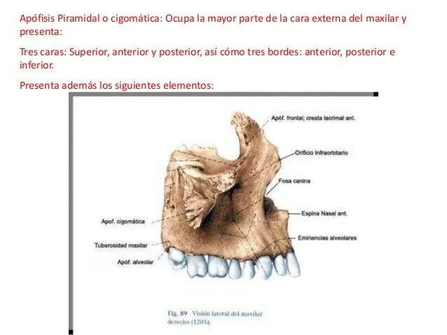 maxilar-superior-3-638.jpg?cb= ...
