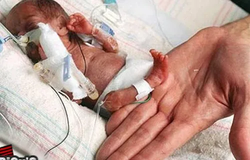 Menor bebê prematuro do país terá alta amanhã | Prematuridade.com Menor bebê prematuro do país terá alta amanhã | Prematuridade.com