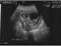 Nueva foto del bebé