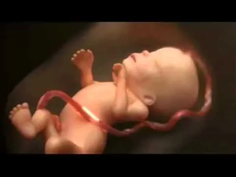 Cuando se realiza un aborto químicamente o por desprendimiento del ... Cuando se realiza un aborto químicamente o por desprendimiento del ...