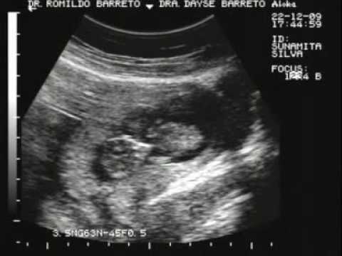 Meu bebe na barriga da mamae com 3 meses de vida! - YouTube Meu bebe na barriga da mamae com 3 meses de vida! - YouTube