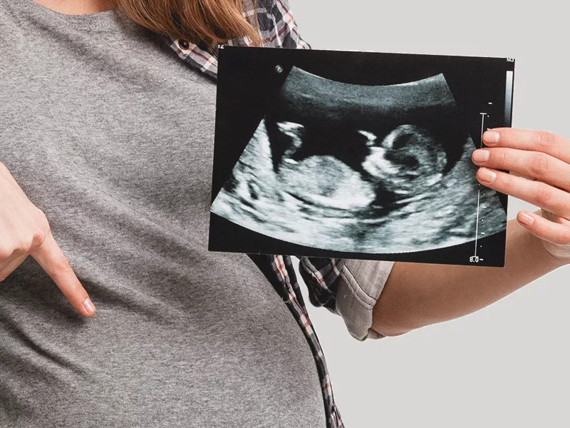Qué es y cuánto mide el saco gestacional por semanas (¡con infografías!) Qué es y cuánto mide el saco gestacional por semanas (¡con infografías!)