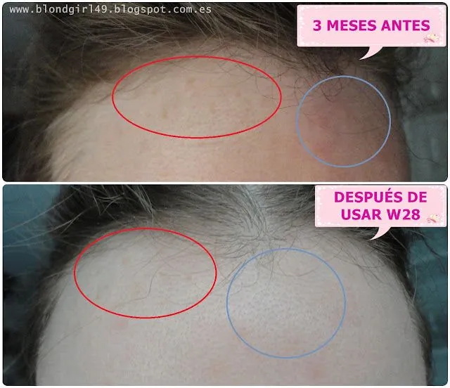 No me mires ♥: Probando W28 (reductor de manchas) de Éternelle No me mires ♥: Probando W28 (reductor de manchas) de Éternelle
