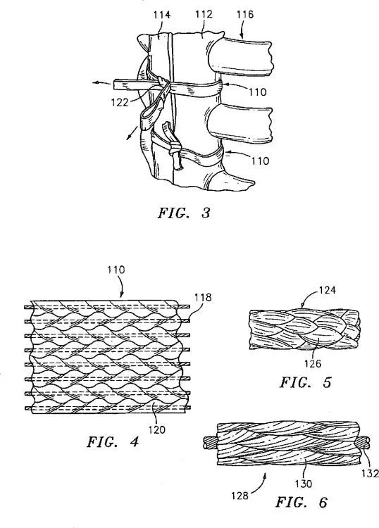 Moldes Quirúrgicos; Moldes de Yeso; Moldes de Fibra de Vidrio ...
