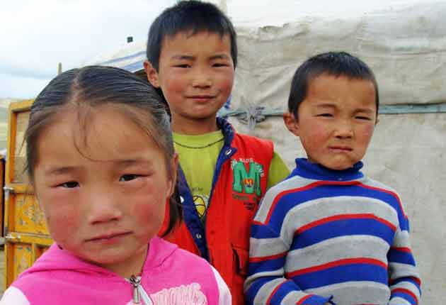 Por qué mongol se usa despectivamente como sinónimo de síndrome de ...