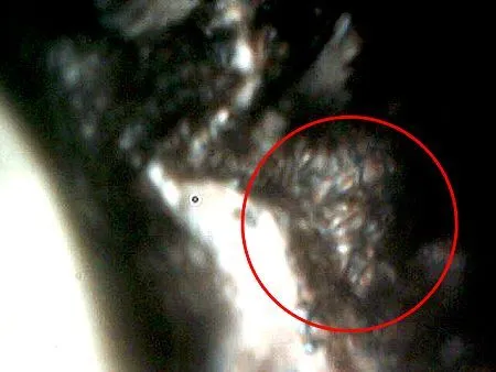 Morgellons: ¿nanotecnología intrusa en nuestro cuerpo? | Morgellons: ¿nanotecnología intrusa en nuestro cuerpo? |