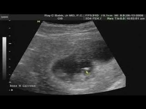 Nuestros morochos a 10 semanas y tres dias - YouTube Nuestros morochos a 10 semanas y tres dias - YouTube