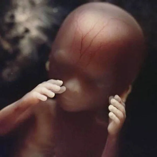 Movimientos de izquierda rechazan públicamente todo tipo de aborto ... Movimientos de izquierda rechazan públicamente todo tipo de aborto ...