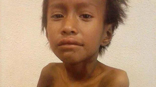 Muere por tuberculosis y malnutrición un niño indígena en Argentina Muere por tuberculosis y malnutrición un niño indígena en Argentina