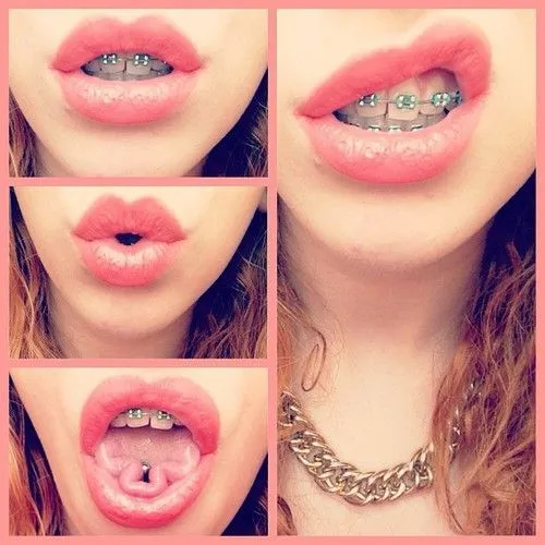 Brackets on Pinterest | Braces, Braces Colors and Fake Braces