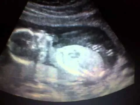Mi niña ,ecografia a las 16 semanas de embarazo. - YouTube Mi niña ,ecografia a las 16 semanas de embarazo. - YouTube