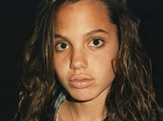 De niñas feas a famosas bonitas