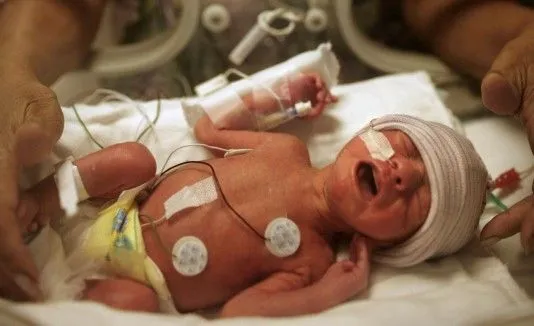 Los niños prematuros crecen más rápido en sus primeros años Los niños prematuros crecen más rápido en sus primeros años