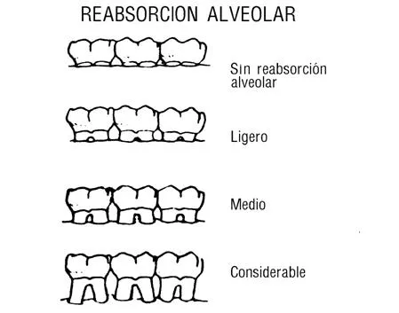 Notas de antropología para medicos forenses (página 3) - Monografias.