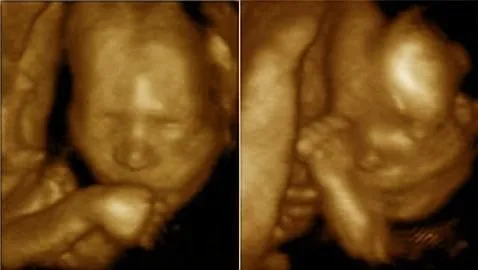 Noticias de Salud: Descubren cómo los gemelos se tocan y acarician ... Noticias de Salud: Descubren cómo los gemelos se tocan y acarician ...