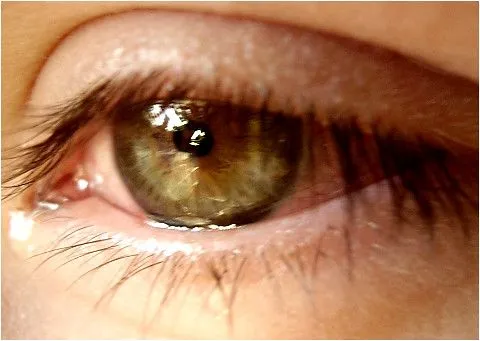mi ojo llorando n.n | Flickr - Photo Sharing!