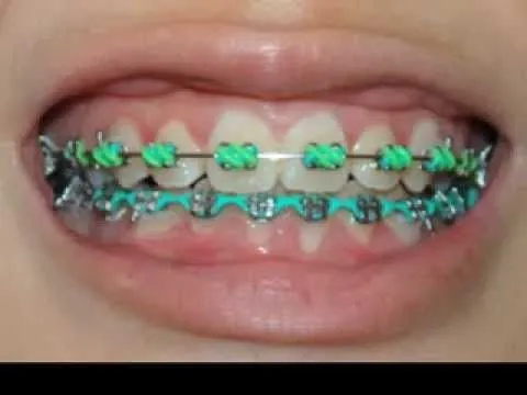 Brackets de colores fosforesentes - Imagui