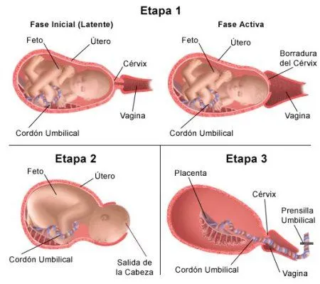 Trabajo de Parto. - Taringa!