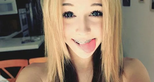Cosas que le pasan a todas las personas que usan BRACKETS Cosas que le pasan a todas las personas que usan BRACKETS