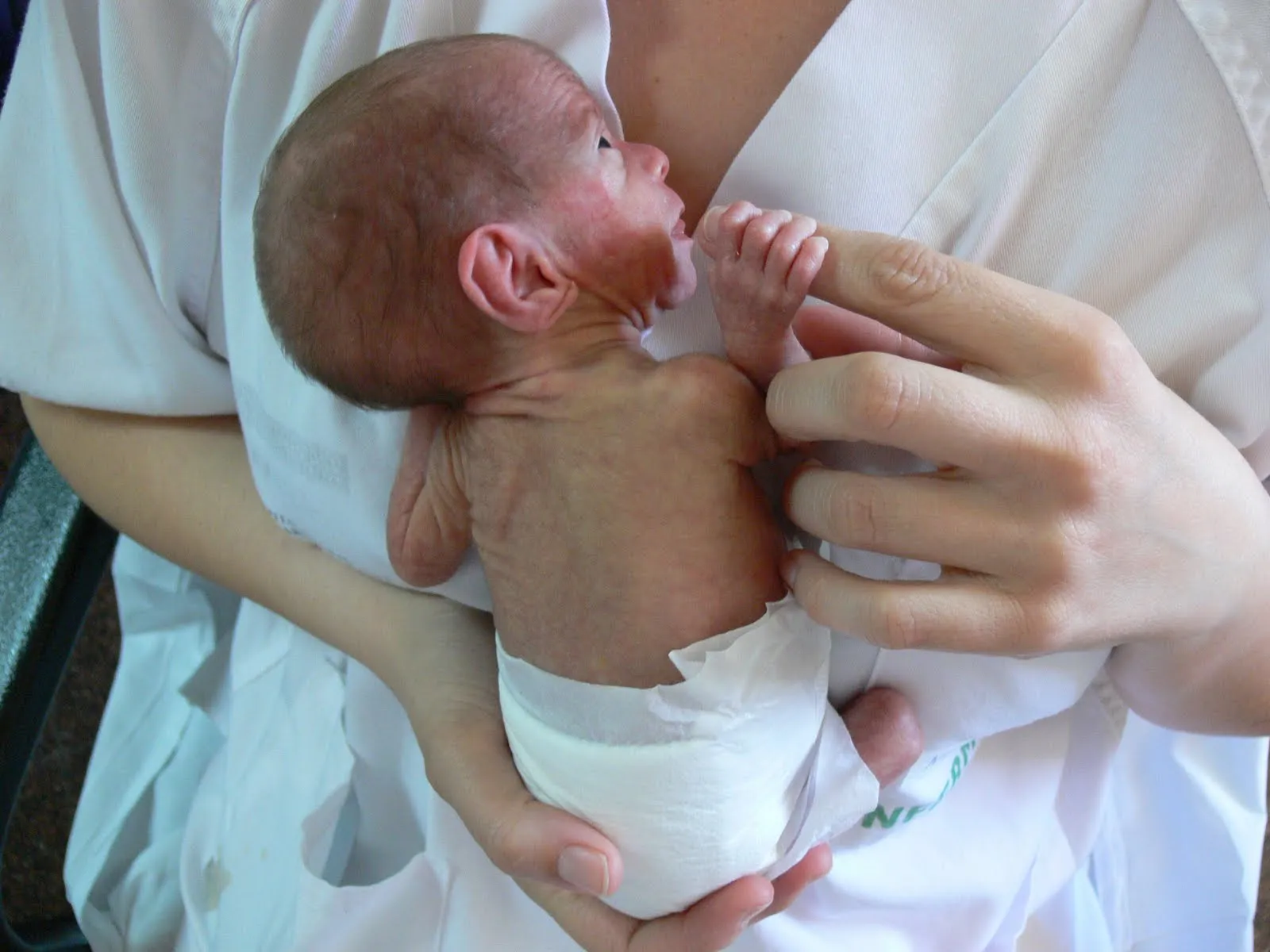 Pediatría Basada en Pruebas: Nuestros Prematuros, mucho más que ... Pediatría Basada en Pruebas: Nuestros Prematuros, mucho más que ...