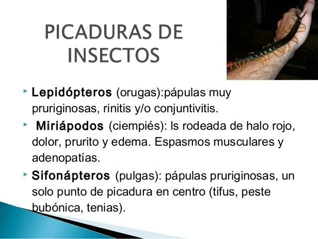 Picaduras comp