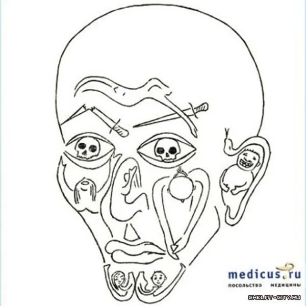 Pinturas hechas por enfermos mentales – Marcianos Pinturas hechas por enfermos mentales – Marcianos