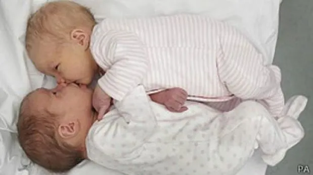 Qué posibilidades hay de tener tres veces mellizos? | Actualidad ...