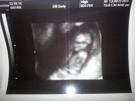les presento a mi baby <3 en mi nuevo ultrasonido a mis 13 semanas ... les presento a mi baby <3 en mi nuevo ultrasonido a mis 13 semanas ...