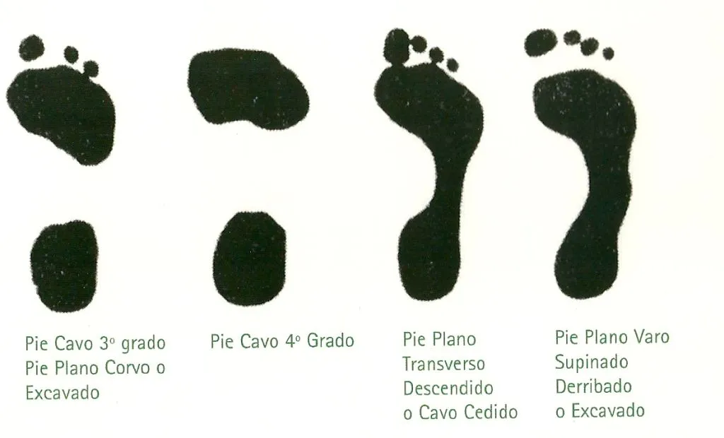 Productos y Servicios para tus pies y cuerpo: Podología: Pie ...