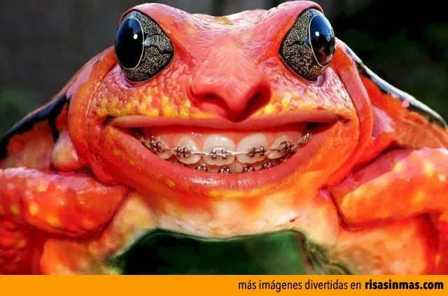 Pronto tendré una sonrisa perfecta