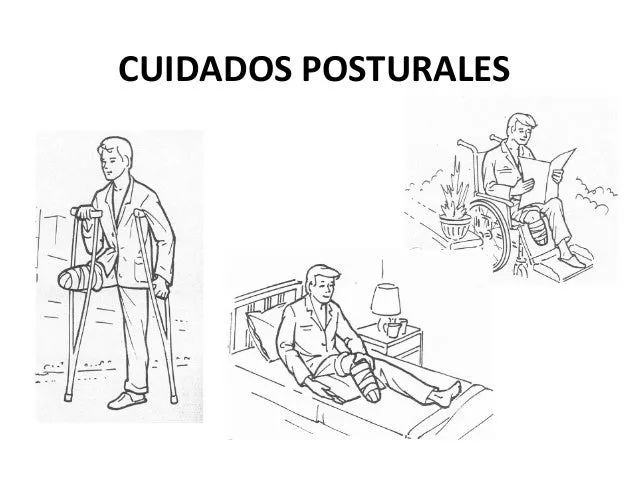 protesis-amputados-y-chequeo- ...