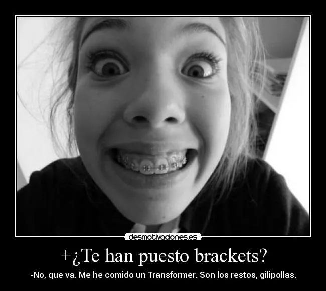 Te han puesto brackets? | Desmotivaciones