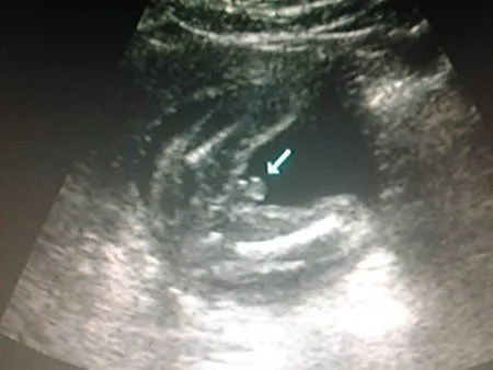 Pues resulta que es Principe! - Bebés De Agosto 2014 - BabyCenter