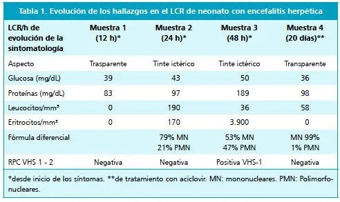 Revista chilena de infectología - Encefalitis herpética neonatal ... Revista chilena de infectología - Encefalitis herpética neonatal ...
