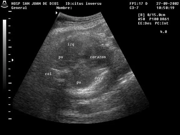 Revista chilena de obstetricia y ginecología - DIAGNOSTICO ... Revista chilena de obstetricia y ginecología - DIAGNOSTICO ...