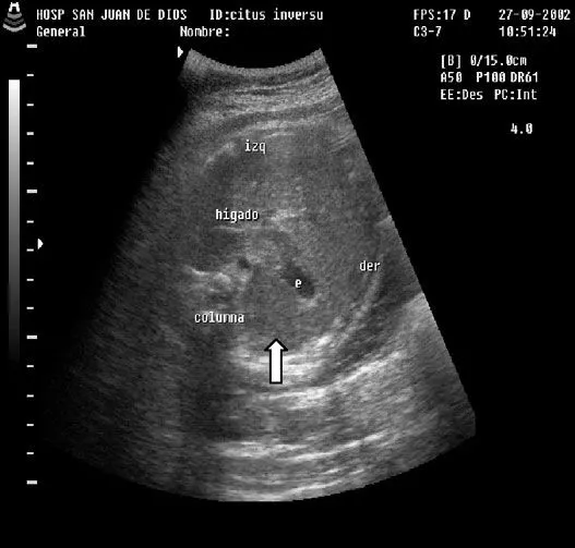 Revista chilena de obstetricia y ginecología - DIAGNOSTICO ... Revista chilena de obstetricia y ginecología - DIAGNOSTICO ...