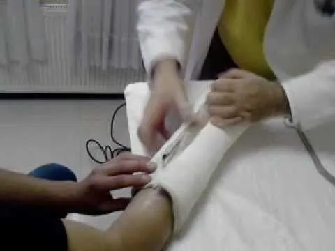 Sacando yeso del brazo - YouTube