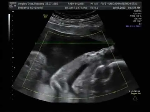 SAMUEL!!! Ecografía 6 meses de embarazo FELICIDAD INFINITA! - YouTube