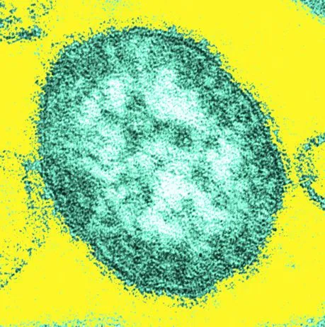 Sarampión: Epidemiología