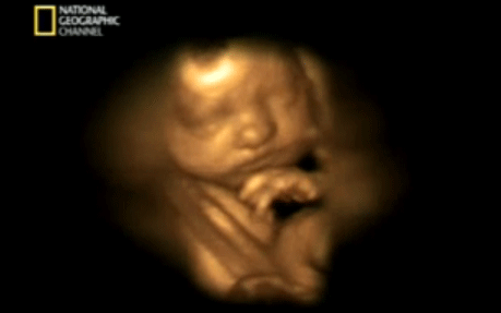 SEMANA 26: Ya está en posición fetal | Club Madres SEMANA 26: Ya está en posición fetal | Club Madres