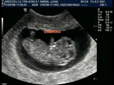 9 Semanas - 9 Weeks - YouTube