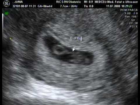9 Semanas - 9 Weeks - Youtube Downloader mp3 9 Semanas - 9 Weeks - Youtube Downloader mp3
