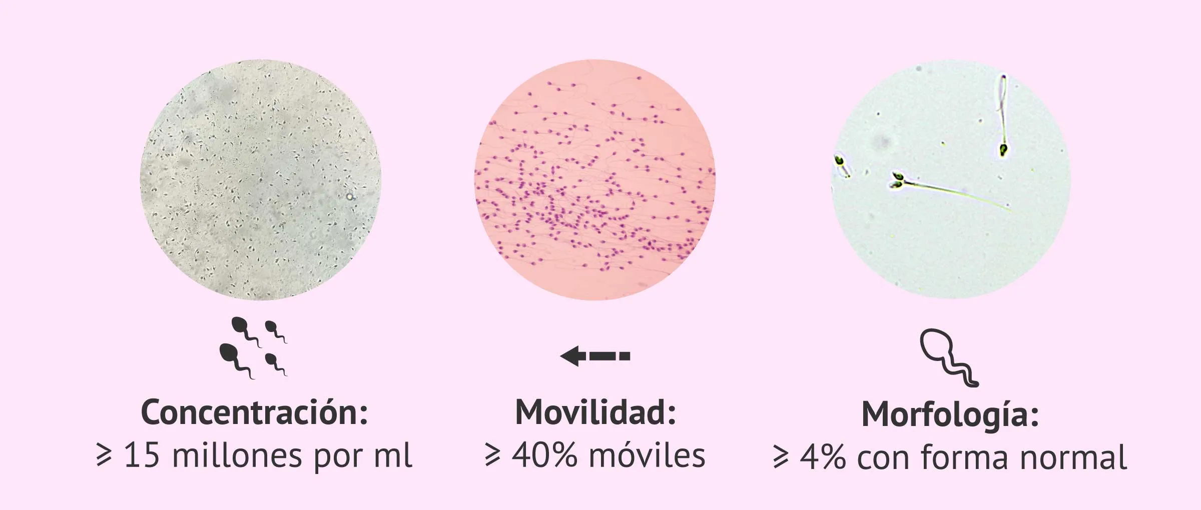 Qué es un seminograma básico y cómo se hace paso a paso? Qué es un seminograma básico y cómo se hace paso a paso?