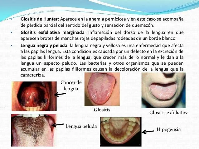 El sentido del gusto(lengua)