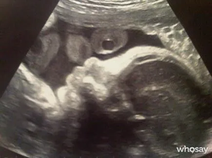 SHAKIRA Y PIQUÉ ENSEÑAN LA PRIMERA FOTO DE SU BEBÉ | Jimena's Blog SHAKIRA Y PIQUÉ ENSEÑAN LA PRIMERA FOTO DE SU BEBÉ | Jimena's Blog