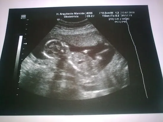 Que significa soñar con ecografia | Significado de los sueños ... Que significa soñar con ecografia | Significado de los sueños ...