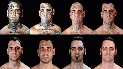 Se somete a 25 operaciones para eliminar tatuajes nazis | dtodom ... Se somete a 25 operaciones para eliminar tatuajes nazis | dtodom ...
