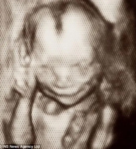 Puede sonreir un bebé a las 17 semanas de gestación? | Blog de ... Puede sonreir un bebé a las 17 semanas de gestación? | Blog de ...
